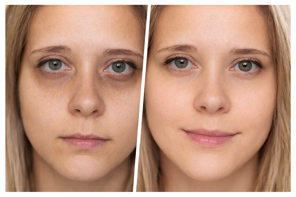 Professional Solutions for Tired, Dull, and Aging Skin